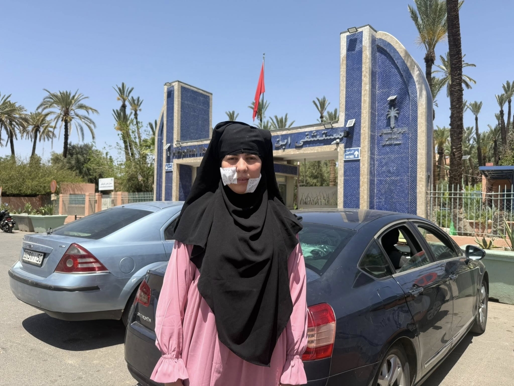 بعد التلميذة سلمى.. الشيخة خديجة ضحية التشرميل تحل بمراكش للخضوع للتجميل