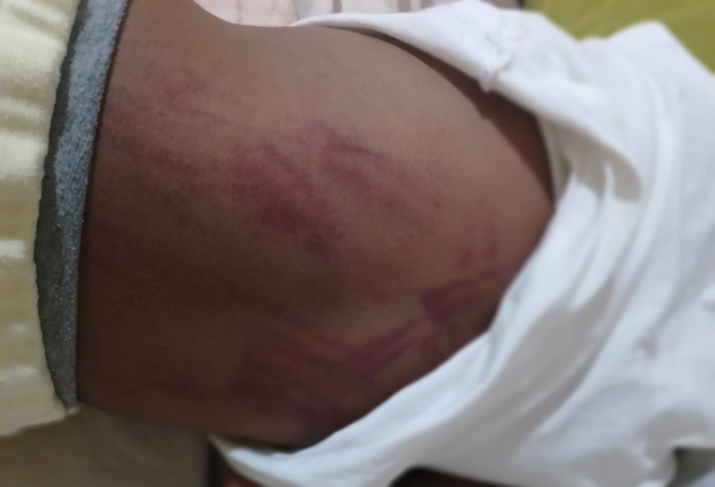 اعتداء شنيع على طفل في حصة دعم تربوي بمراكش والأسرة تتساءل عن ملابسات عدم فتح تحقيق