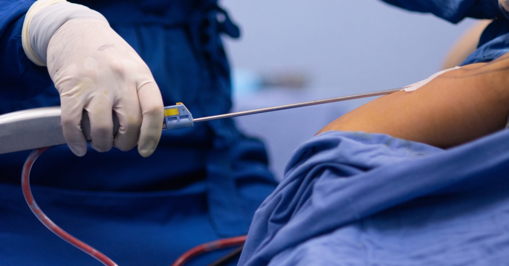 حماة المستهلك لـ”كشـ24″: يجب إخضاع مصحات التجميل الخاصة للمراقبة