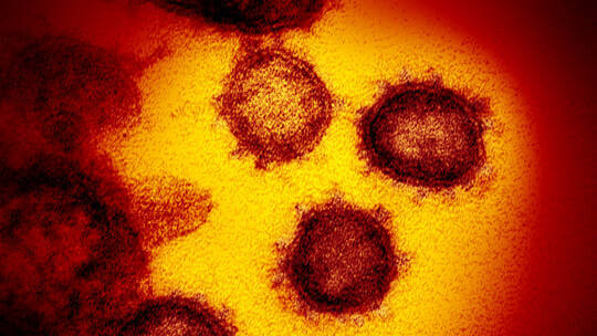 علماء أتراك يلتقطون صورة عالية الدقة لفيروس كورونا 